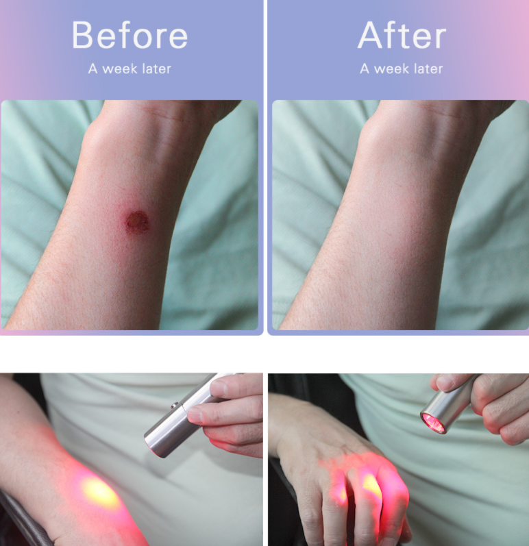 Peak Society Red Light Therapy Wand – Portable Red & Near-Infrared